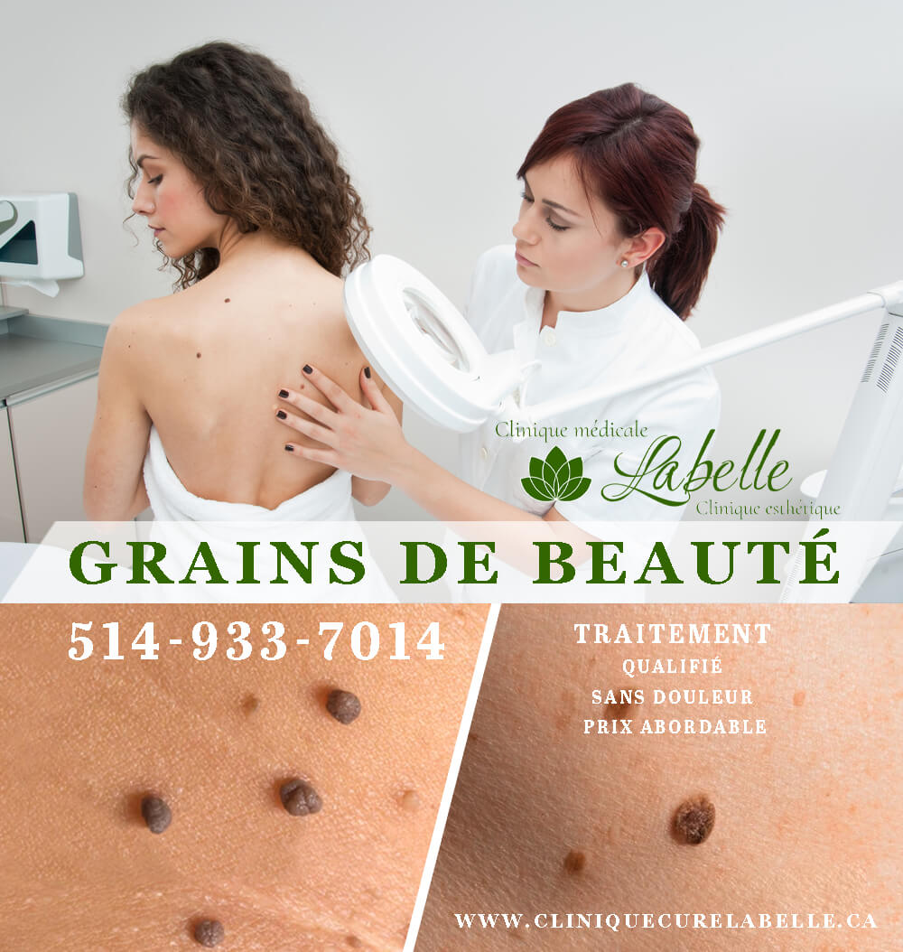 GRAINS DE BEAUTÉ Traitement qualifié, sans douleur, à un prix abordable! Clinique Médicale
