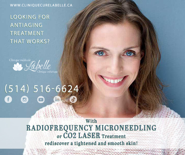 ANTIAGING TREATMENT THAT WORKS - RADIOFREQUENCY MICRONEEDLING or CO2 LASER TREATMENT