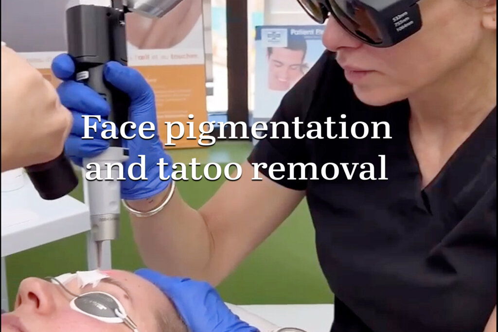 Face pigmentation and tatoo removal now is faster and more efficient with the technology of Picolaser!