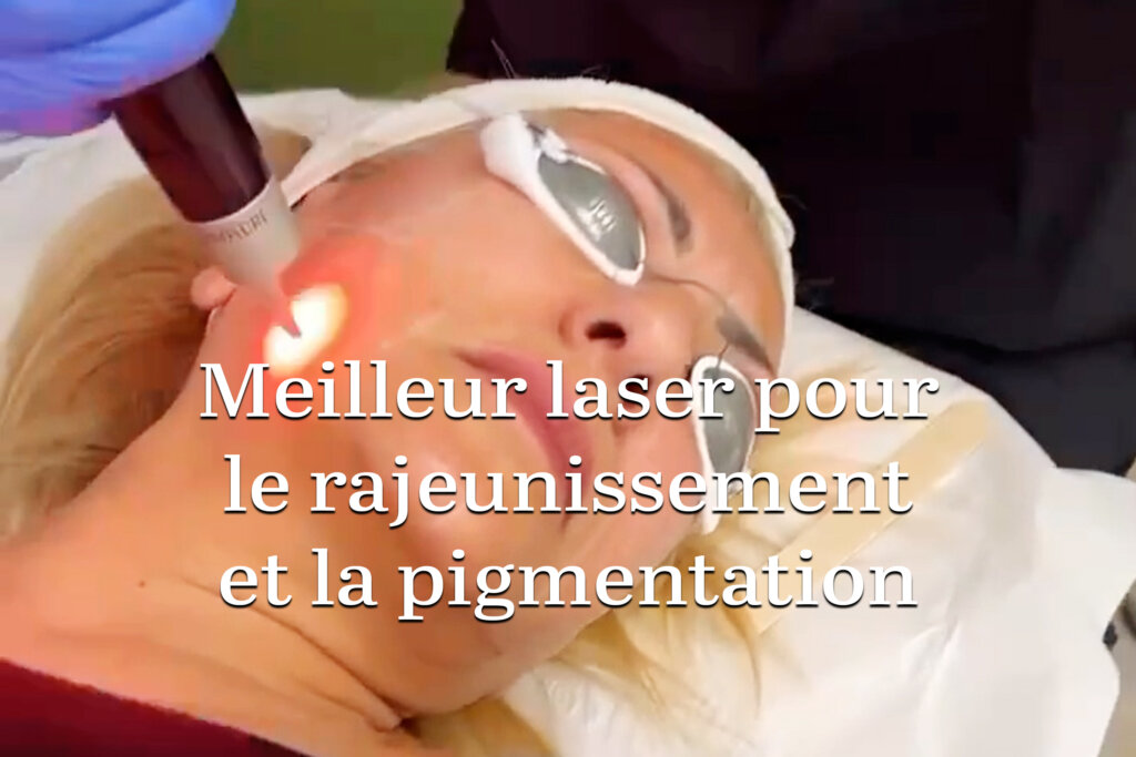 Meilleur laser pour le rajeunissement et la pigmentation