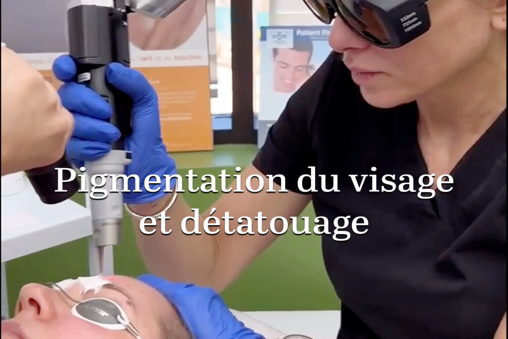 Pigmentation du visage et le détatouage