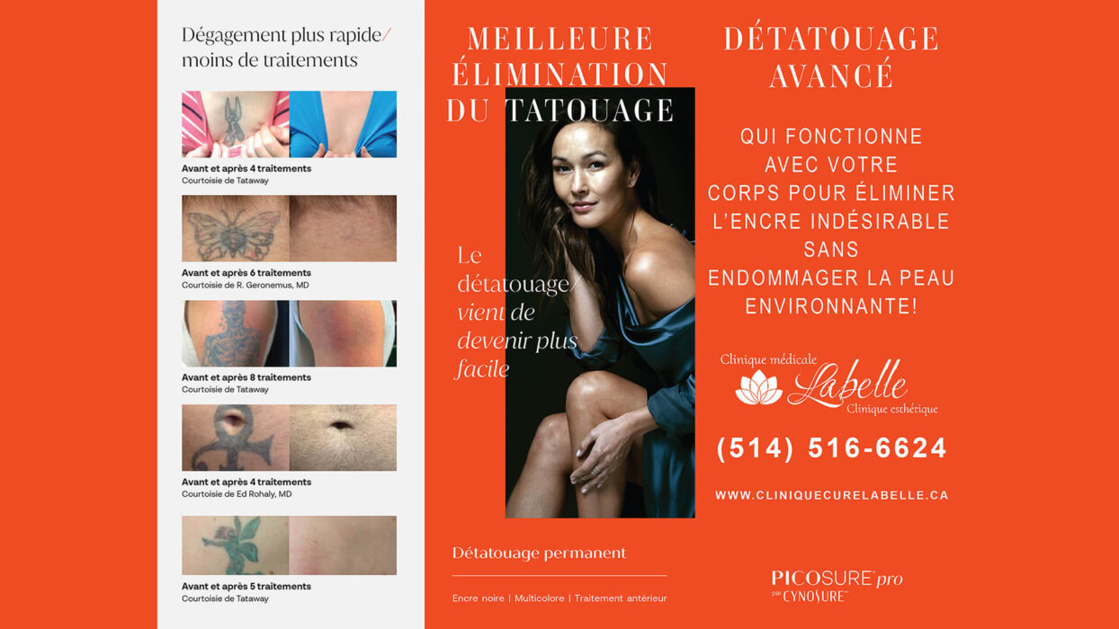 Détatouage avec le laser Picosure Pro à Laval et dans la grande région de Montréal. Prix pour le traitement detatouage avec Laser PicoSure Pro