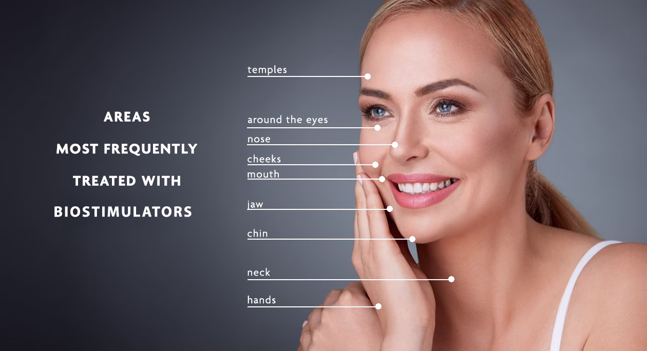 Radiesse in Laval and the Greater Montreal Area. Five reasons why you might consider using Radiesse biostimulator injections.
